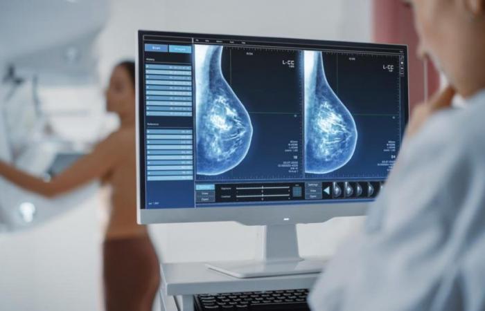 A promising new protocol against breast cancer