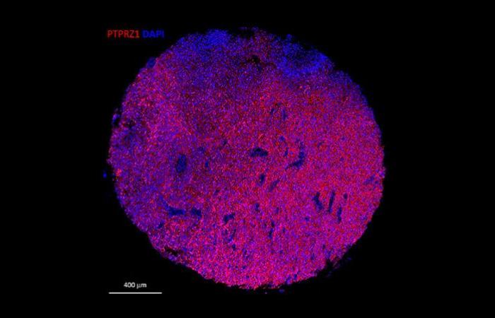 These genetically modified cells attack tumors