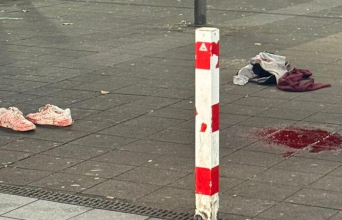 Essen: Man seriously injured in knife attack | News