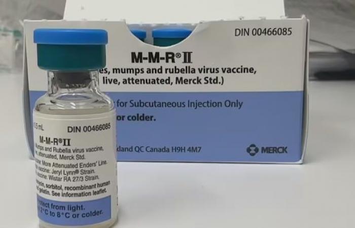 Measles outbreak declared in western NB, 2 people hospitalized