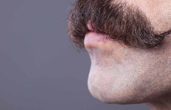 A Moustache Movement to Support Men’s Health