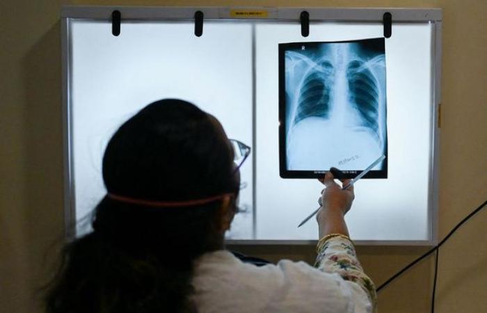 WHO: New world record for tuberculosis cases in 2023