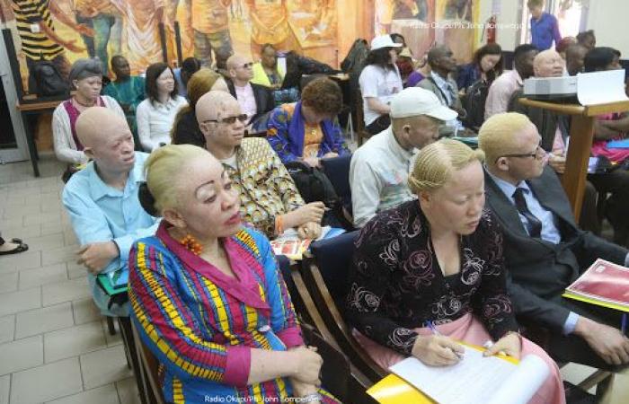 Lubumbashi: a call for help for people with albinism