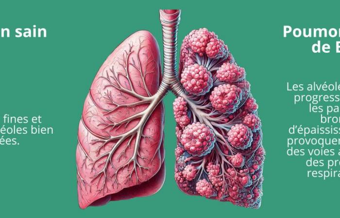 Out of breath on a daily basis? What if it was COPD?