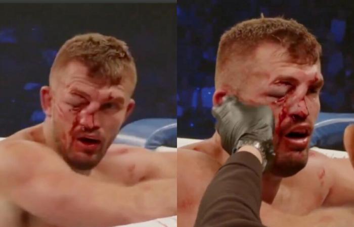 This fighter's face literally collapses