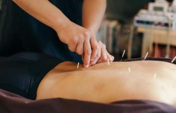 Irritable bowel syndrome: acupuncture relieves symptoms