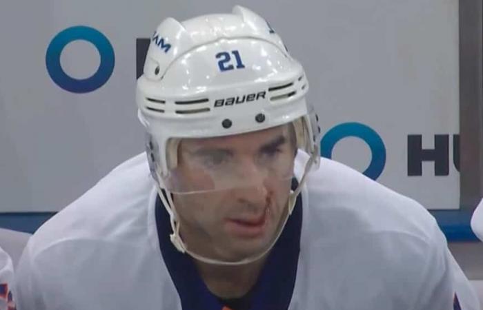 Kyle Palmieri disfigured by a stick