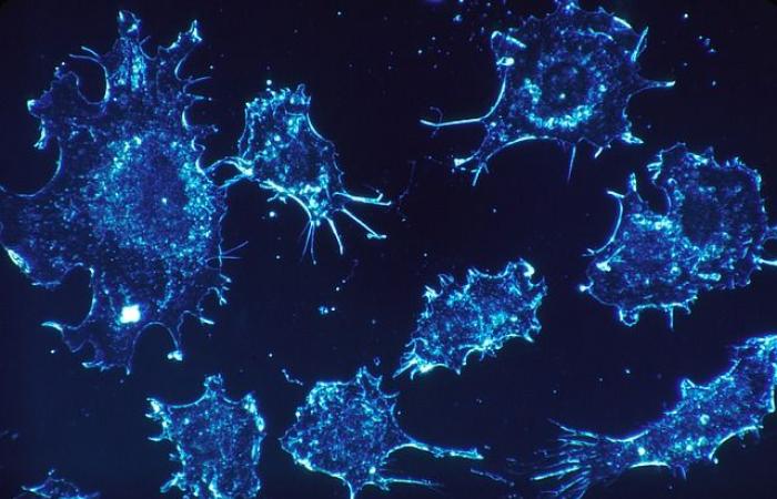 Breakthrough in cancer research at Tel Aviv University