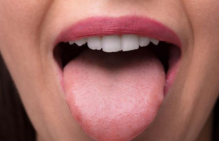 Brushing your tongue, a good oral habit?