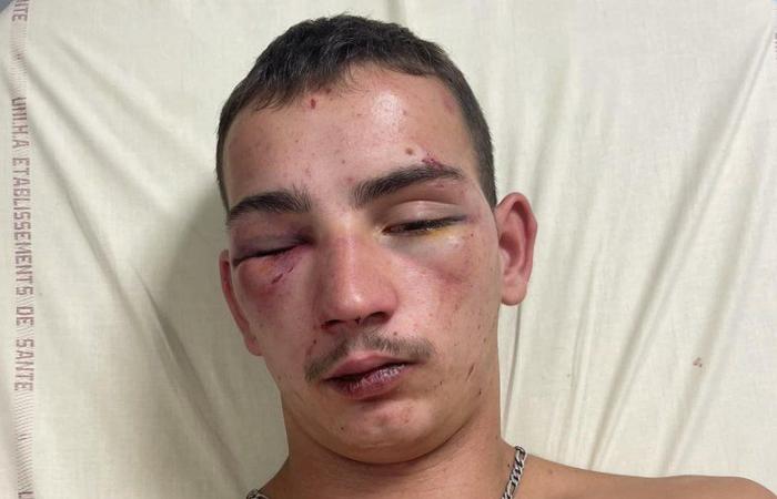 “For a phone and a wallet”: Mathéo, 19, “beaten up and left for dead” by a group of young people while leaving a nightclub