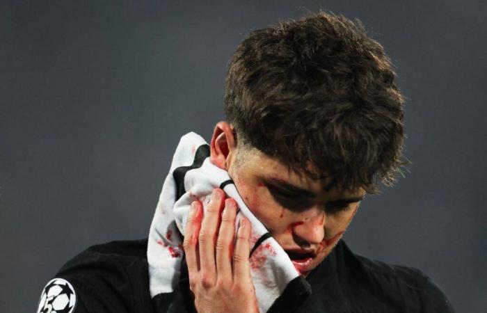 Bloodied FC Barcelona Star Cubarsi Shows Off War Wounds (VIDEO)