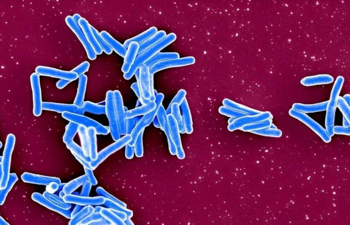 Tuberculosis has once again become the deadliest infectious disease in the world ahead of Covid-19