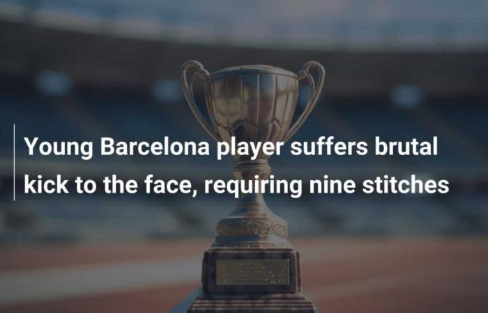 Young Barcelona player suffers brutal kick to the face, requiring nine stitches