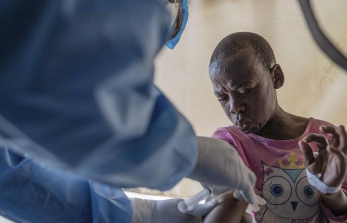 Mpox: WHO launches global vaccination strategy in Africa