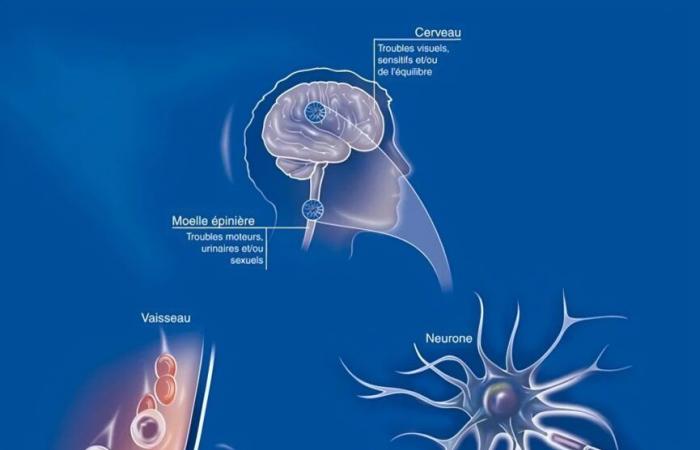 a defect in the reading of genes highlighted ????