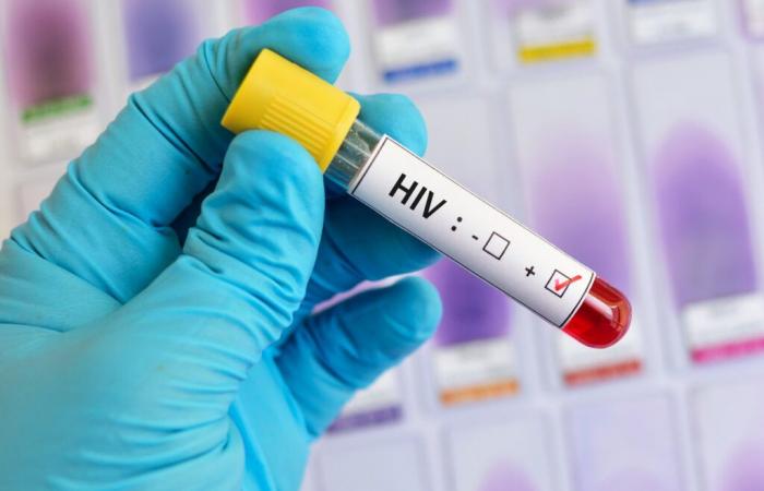 HIV testing and diagnosis: Toronto still in the lead