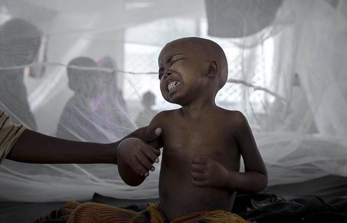 Alarming spread of cholera and dengue fever in Sudan