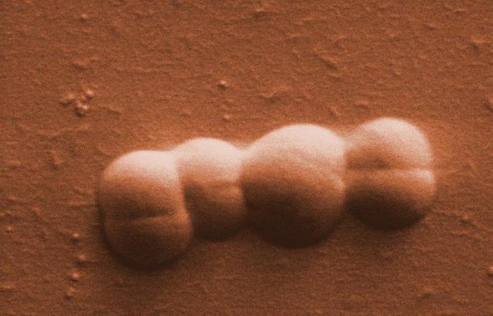 Here is the story of Conan the bacteria, one of the most resistant in the world!