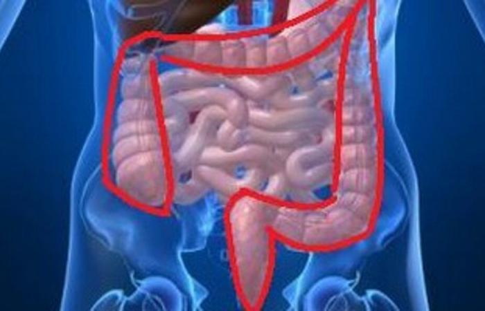 why colon cancer affects increasingly younger patients?