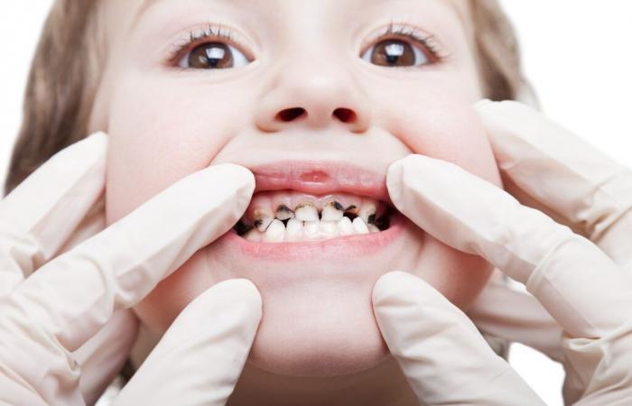 ORAL HEALTH IN CHILDREN: AN EARLY INDICATOR OF OBESITY RISK?