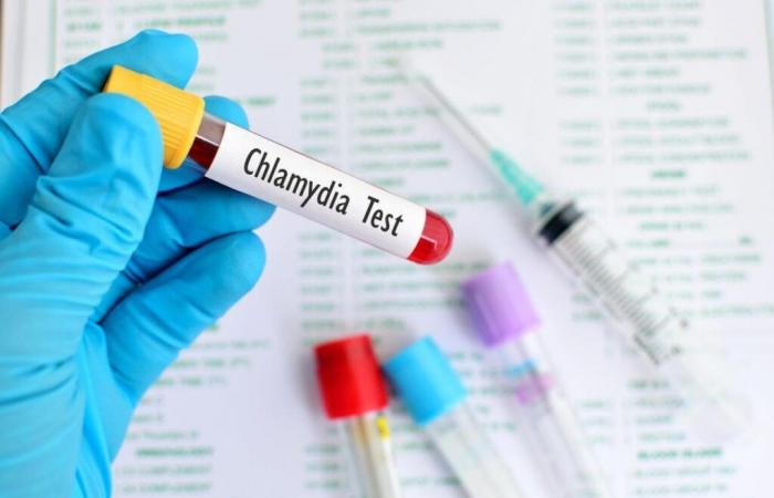 Soon a vaccine against chlamydia? The results of a new test