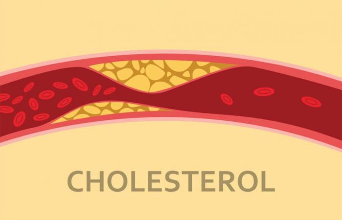 This fruit helps lower cholesterol, study reveals