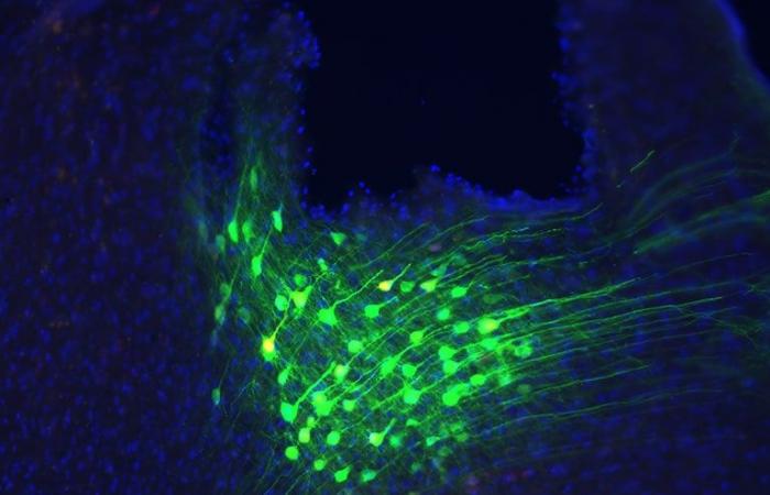 researchers identify a brain circuit linking breathing and emotional calming