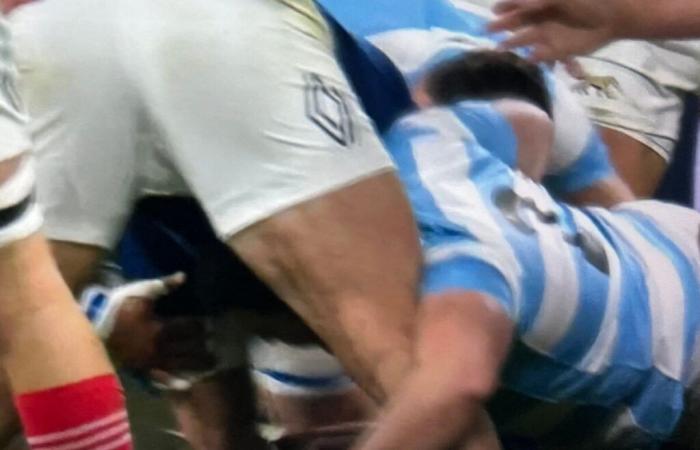 France-Argentina: Jean-Baptiste Gros injured following an anti-gambling act punished with a card