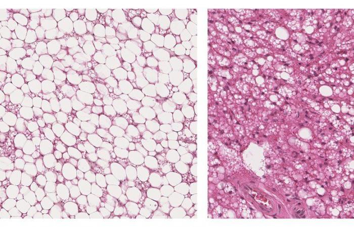 Brown fat: why is this little-known adipose tissue so useful to your health? A Toulouse study opens up new perspectives