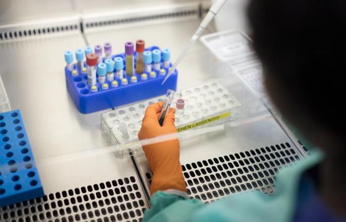 Health: new cases of AIDS infection are falling in Switzerland