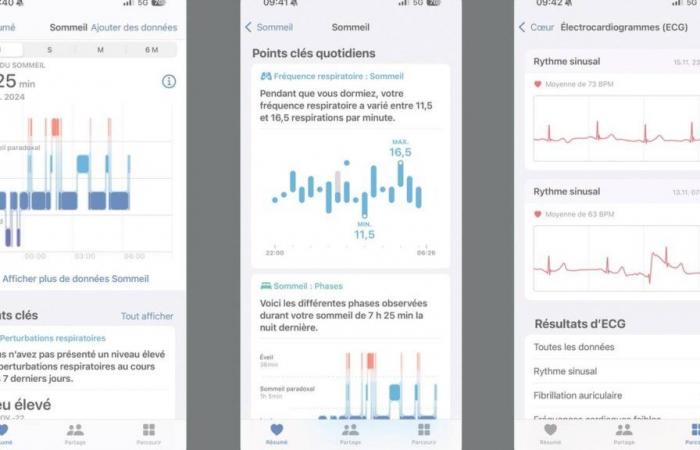 The new Apple Watch measures a colossal mass of data on our health… But how to interpret it?