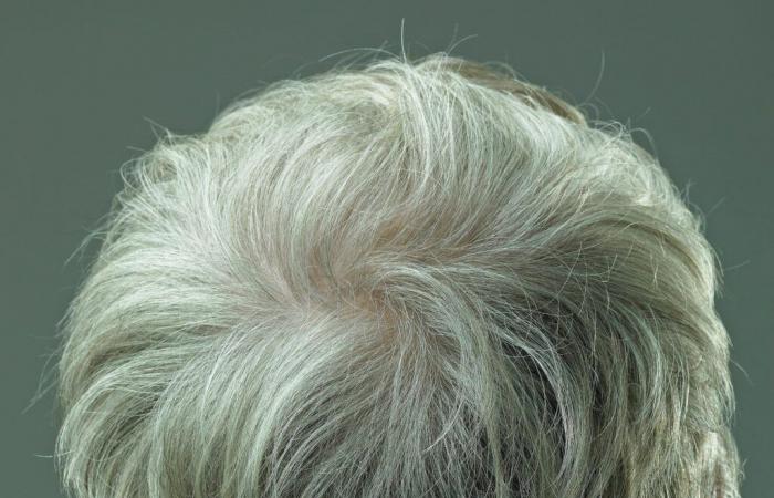 Graying of hair may be reversible, study suggests