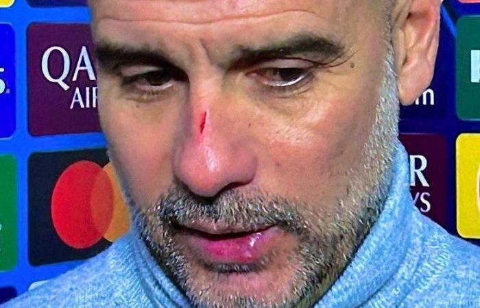 “I wanted to hurt myself”: when Pep Guardiola admits to scratching his face after the incredible draw at Manchester City