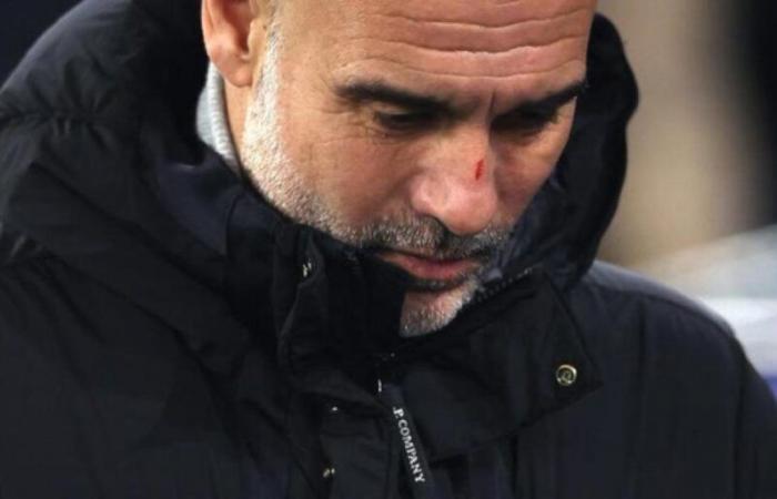 Guardiola qualifies his statements due to the scratches on his face