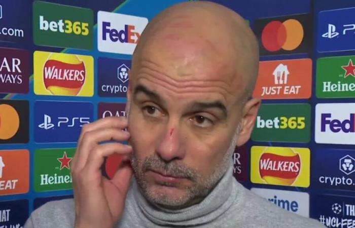 After hurting himself.. Is Guardiola frustrated after the Feyenoord match?