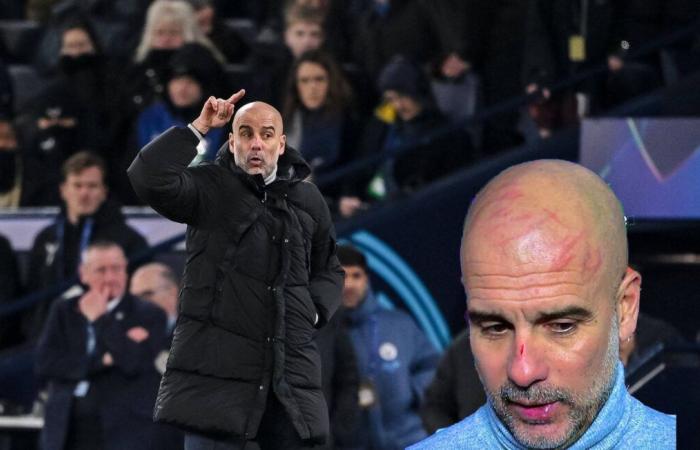 Scratched skull, Guardiola wanted to “hurt himself” after the Feyenoord comeback