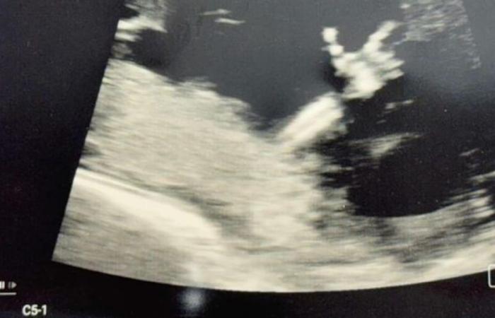 Baby shows ‘Guns Up’ in ultrasound for Denver City doctor, Texas Tech alum