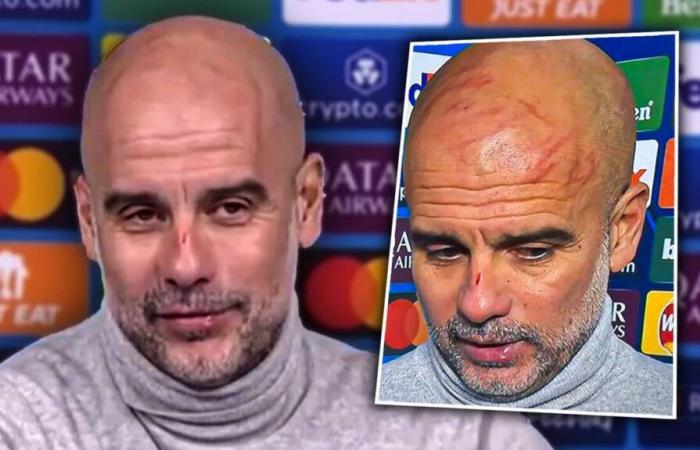 VIDEO. Why Pep Guardiola arrived at the conference with a face full of scratches