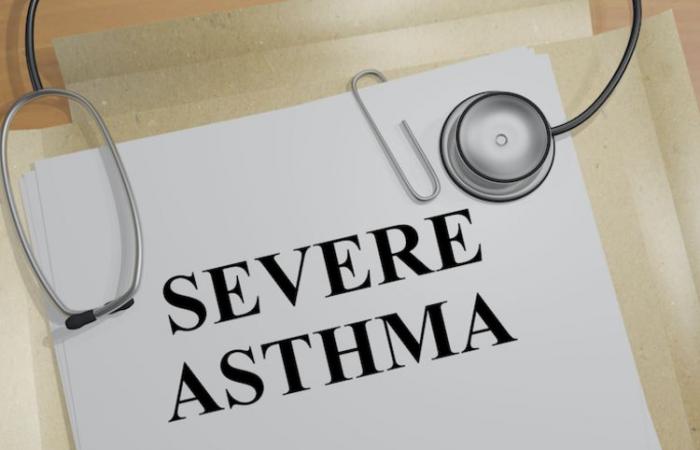 New approach to treating asthma in its severe form