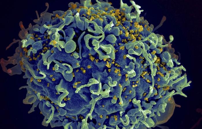 A Montreal breakthrough gives hope for victory against HIV