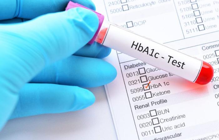 DIABETES: Blood sugar control means less cognitive decline