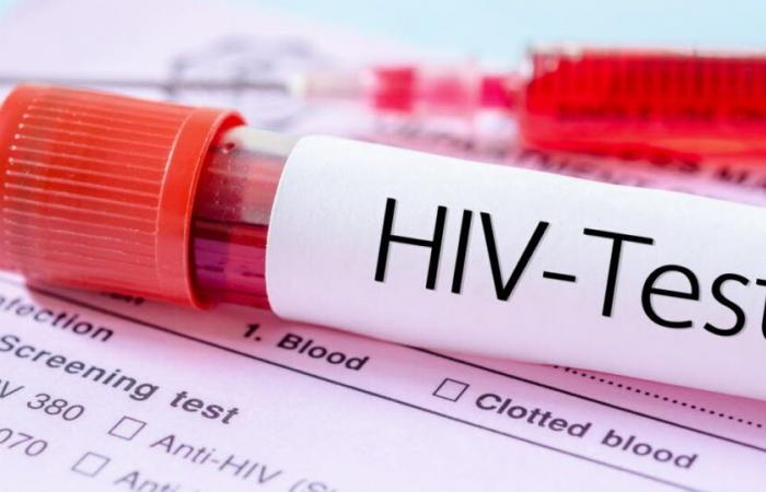 AIDS. HIV: do you know where and how to get tested?