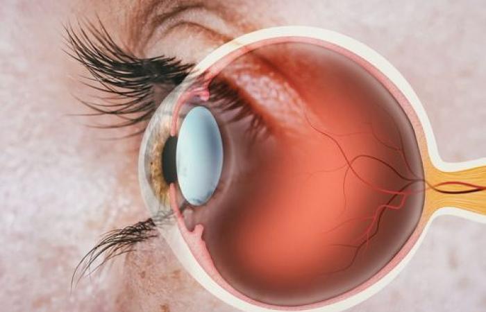 Transplanting stem cells to treat blindness