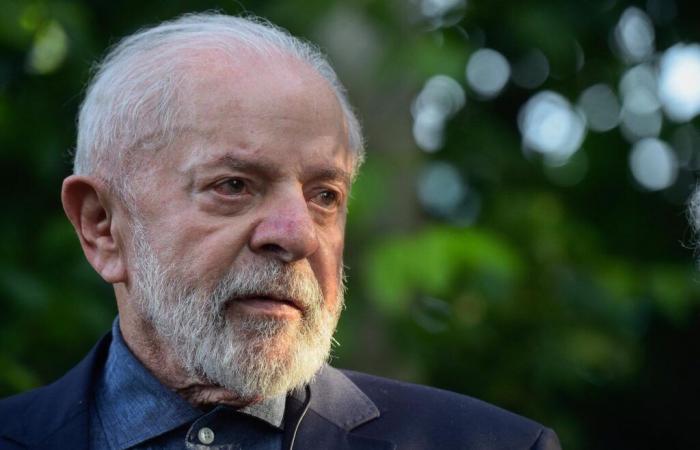 Brazil: Lula operated on for “intracranial hemorrhage”