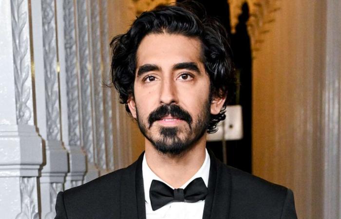 Dev Patel Thinks He Would Have Lost His Own Lookalike Contest