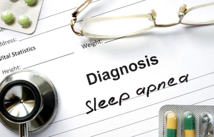 Sleep APNEA: A neglected factor of dementia in the elderly