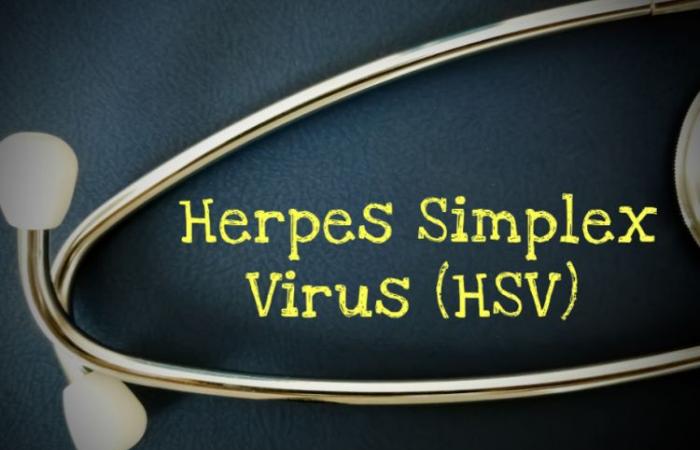 More than one in five adults infected with genital herpes virus