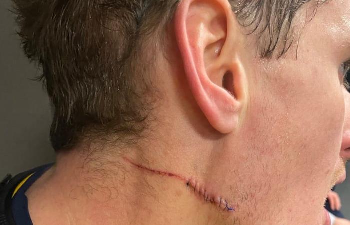 WATCH: Scary neck cut for Michael McCarron