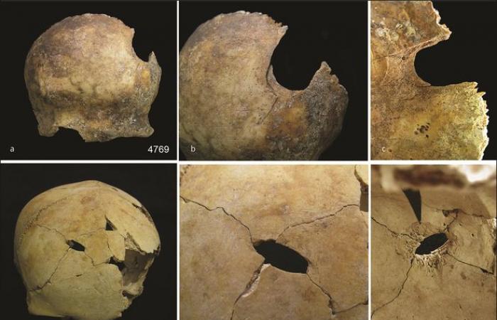 An episode of mass cannibalism is said to have taken place 4,000 years ago in England