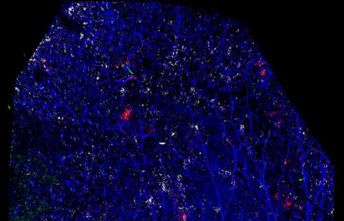 Humoral immunity of the skin, shaped by the microbiota, and its potential for the development of innovative vaccine approaches